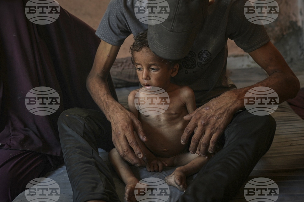 Mideast Wars Gaza Starvation Photo Essay