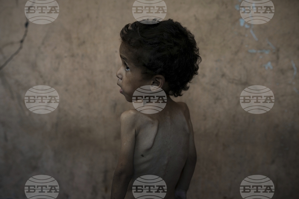Mideast Wars Gaza Starvation Photo Essay