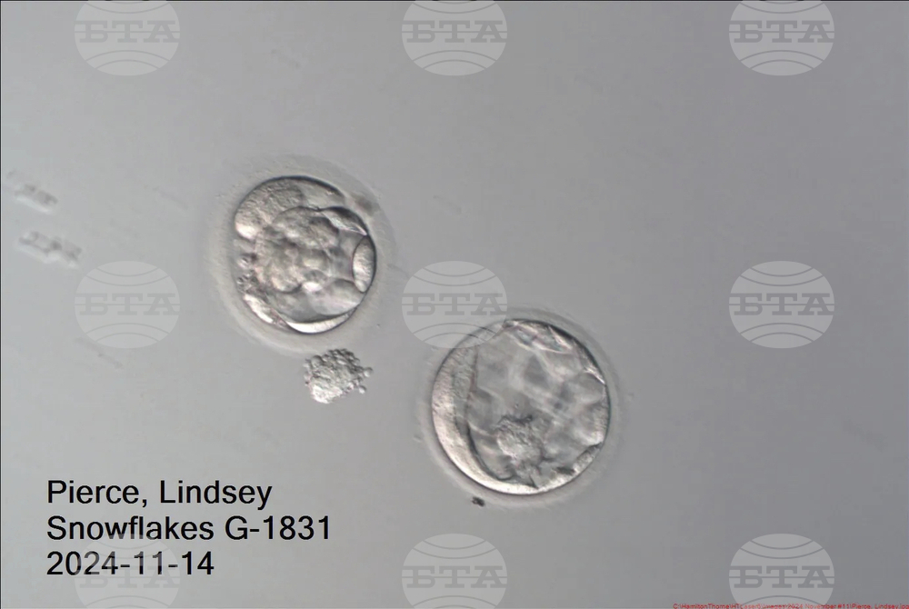 30 Year Old Embryo