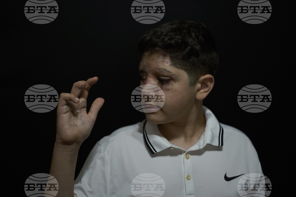 Lebanon Pager Attack Survivors Photo Essay