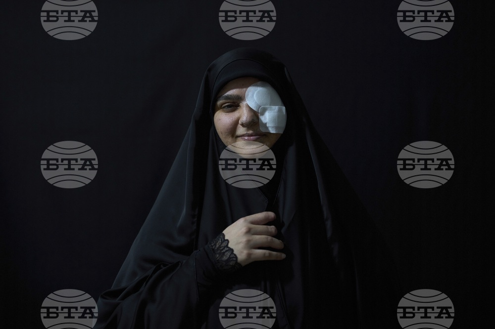 Lebanon Pager Attack Survivors Photo Essay