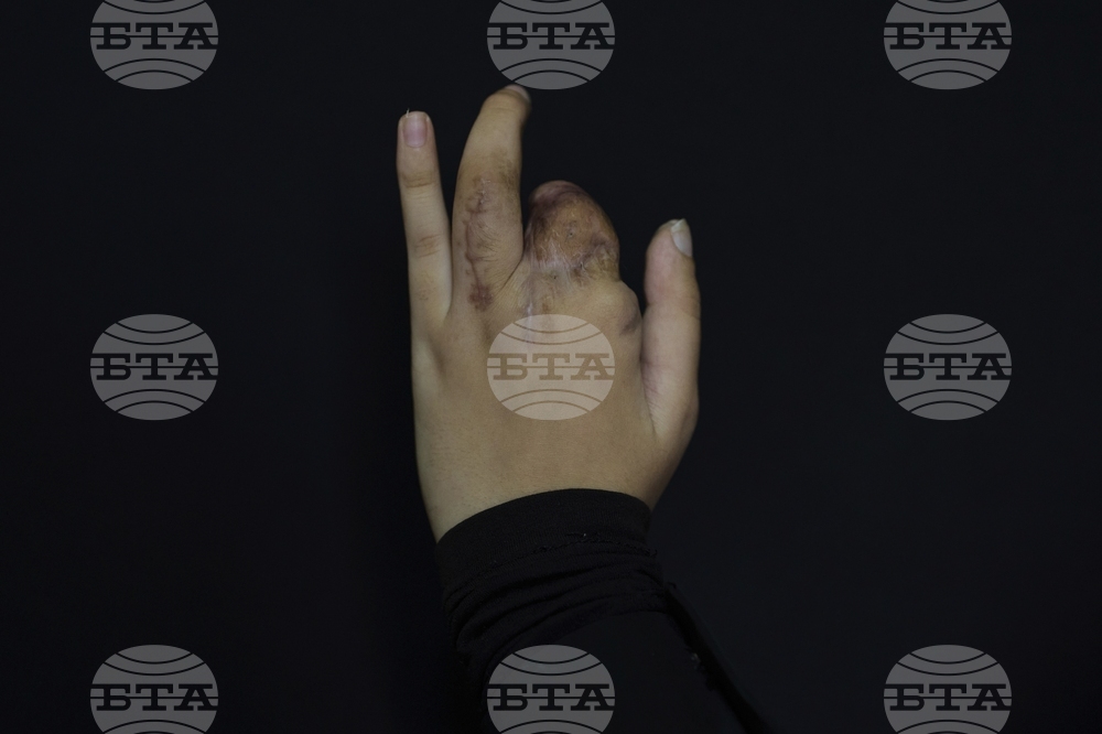 Lebanon Pager Attack Survivors Photo Essay