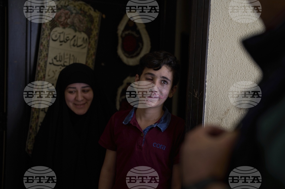 APTOPIX Mideast Wars Lebanon Pager Attack Survivors