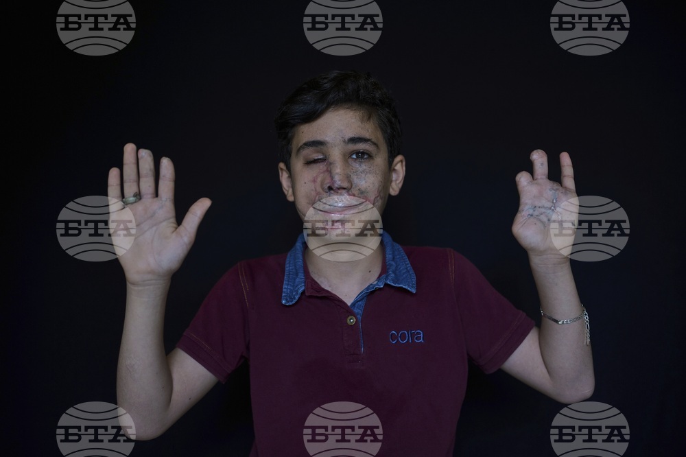 Lebanon Pager Attack Survivors Photo Essay