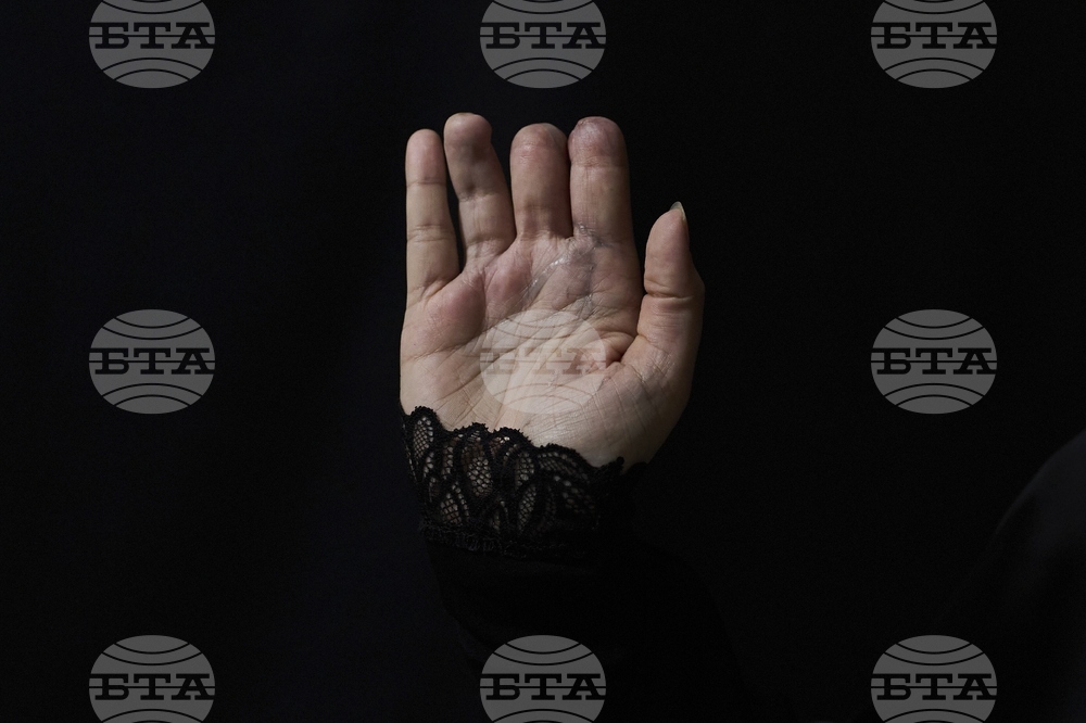 Lebanon Pager Attack Survivors Photo Essay