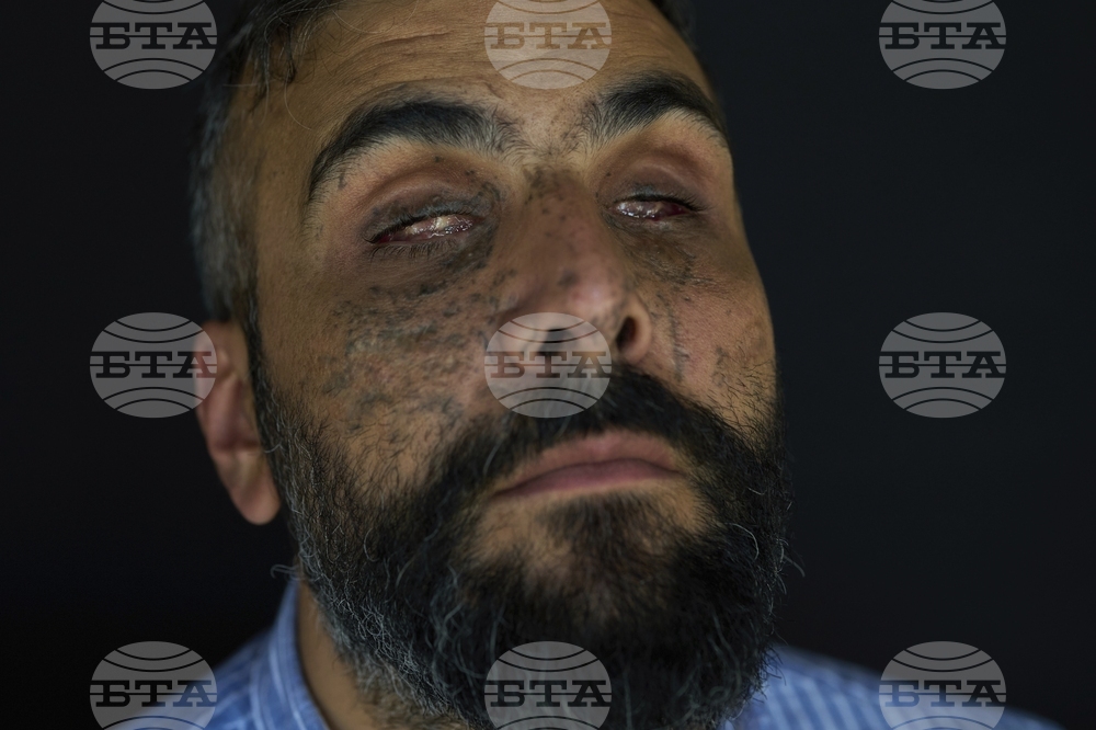 Lebanon Pager Attack Survivors Photo Essay