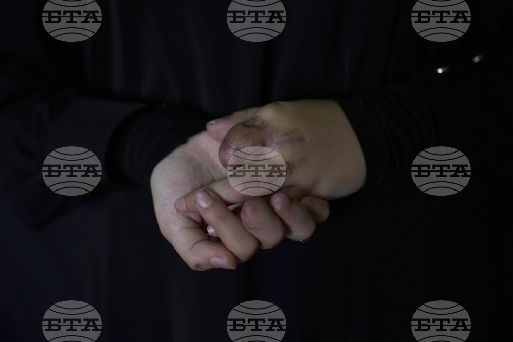 Lebanon Pager Attack Survivors Photo Essay