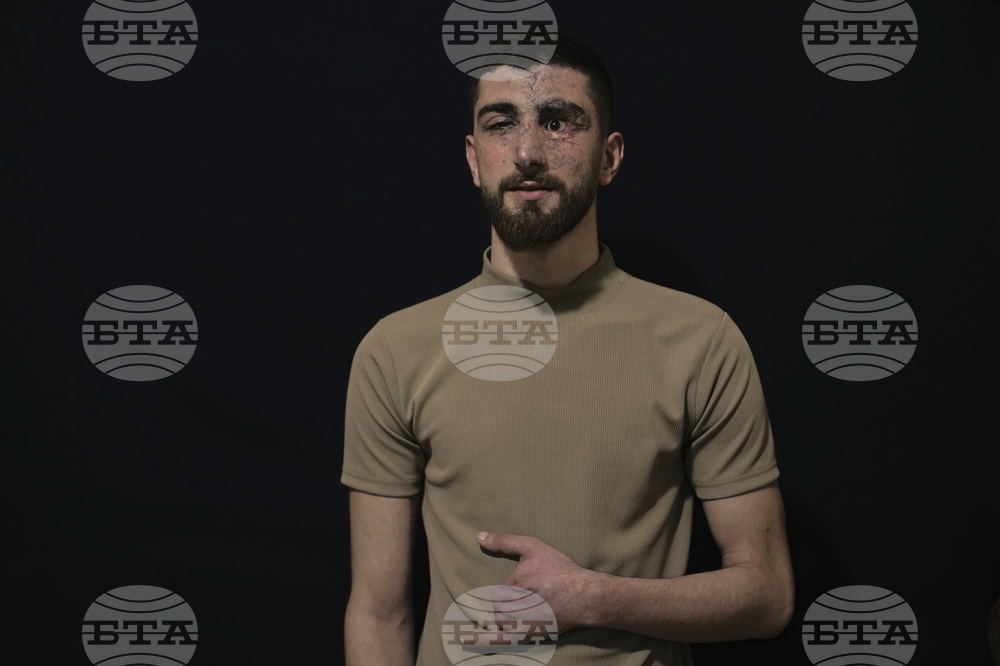 Lebanon Pager Attack Survivors Photo Essay