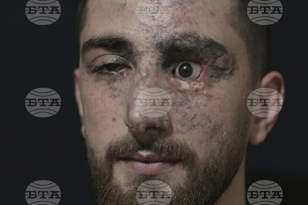 Lebanon Pager Attack Survivors Photo Essay