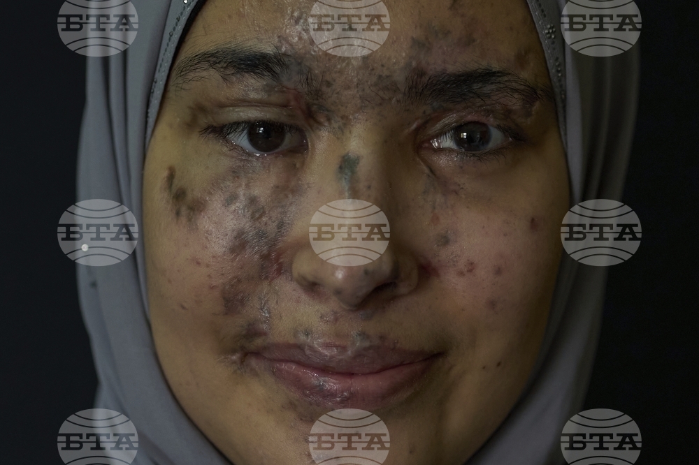 Lebanon Pager Attack Survivors Photo Essay