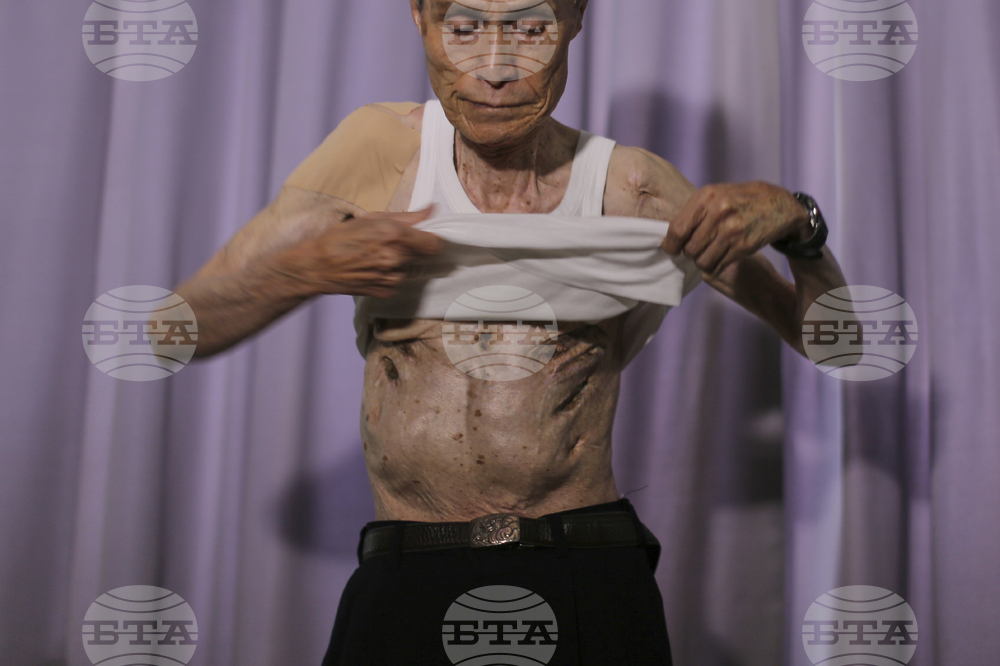 Japan Nagasaki Anniversary Scars Photo Gallery
