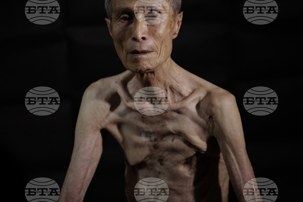 Japan Nagasaki Anniversary Scars Photo Gallery