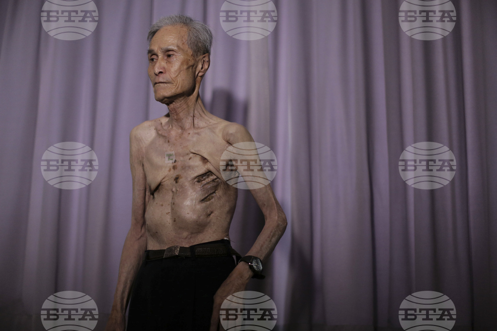 Japan Nagasaki Anniversary Scars Photo Gallery