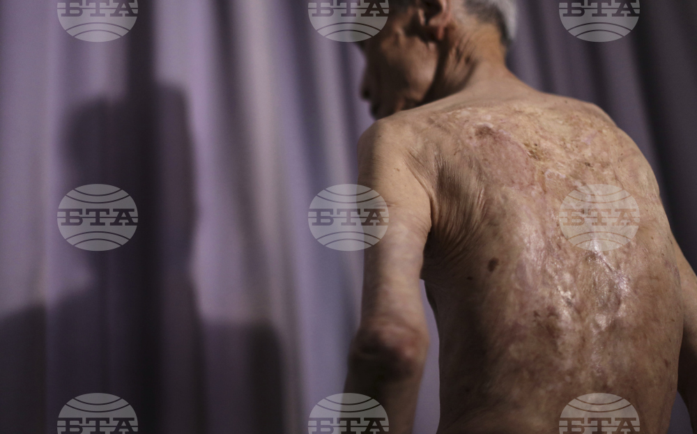 Japan Nagasaki Anniversary Scars Photo Gallery