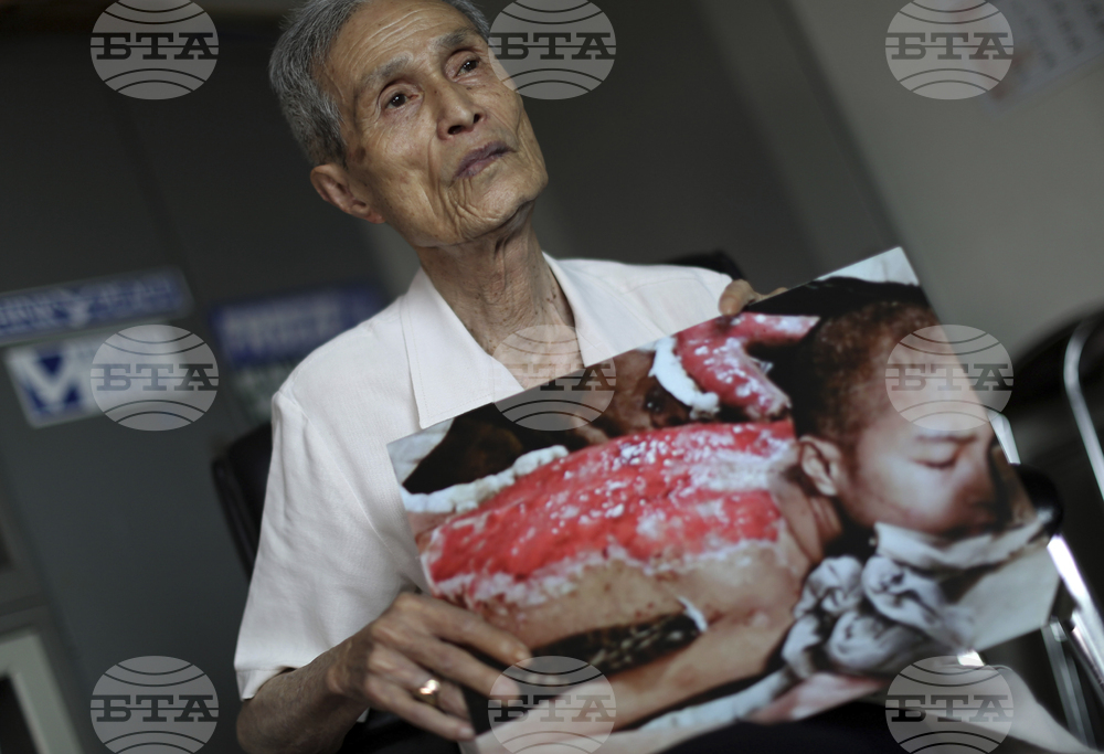 Japan Nagasaki Anniversary Scars Photo Gallery