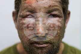 APTOPIX Russia Ukraine War