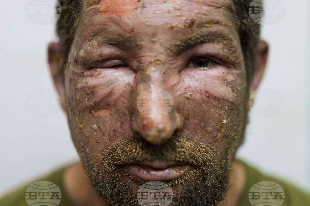 APTOPIX Russia Ukraine War
