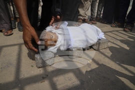 APTOPIX Mideast Wars Gaza Hunger