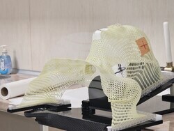 Хасково - лъчетерапия - високотехнологичен апарат