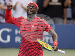 APTOPIX US Open Tennis