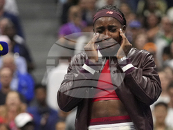 APTOPIX US Open Tennis