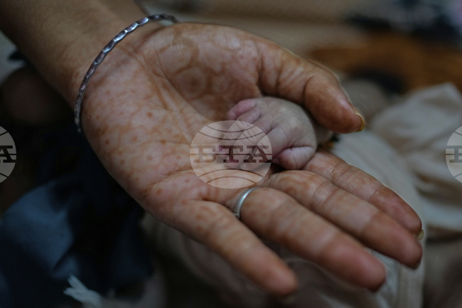 Трима израелски братя станаха бащи на четири деца, родили се в един и същи ден 