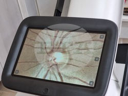 Ямбол - ДКЦ - нова апаратура - очни заболявания