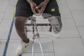 Congo Conflict Injured