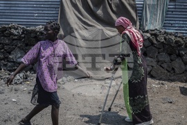 Congo Conflict Injured