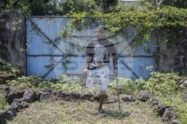 Congo Conflict Injured