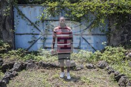 Congo Conflict Injured