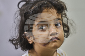 India Kashmir Stray Dogs Photo Gallery