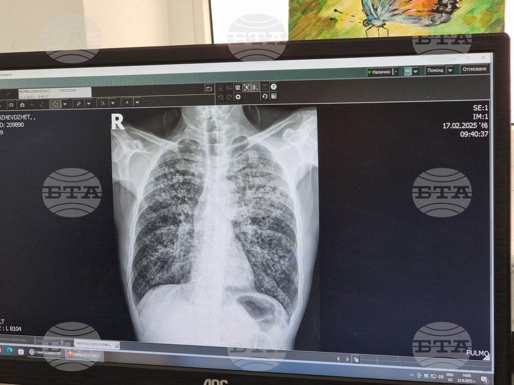  Седмица на отворените врати за контрол на туберкулозата ще има от 8 до 12 декември в сливенската областна болница