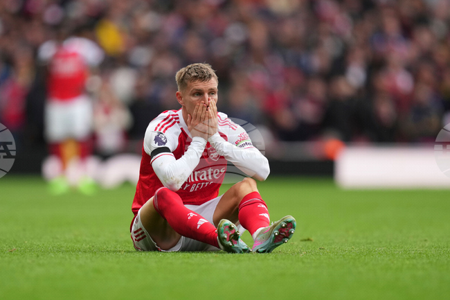 Полузащитникът на Арсенал Мартин Йодегор ще отсъства няколко седмици поради контузия на коляното, заяви мениджърът Микел Артета