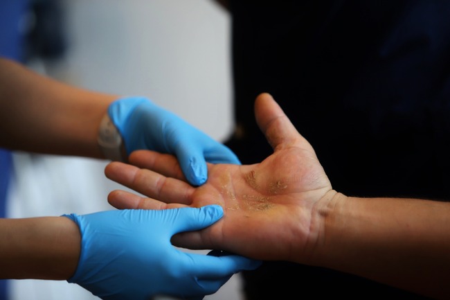 Безплатни прегледи за атопичен дерматит във ВМА