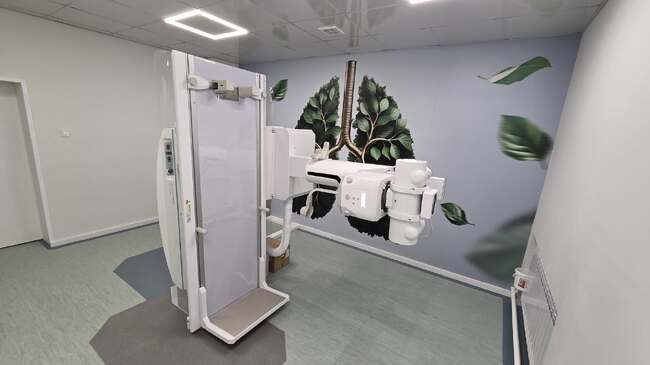 Болницата в Силистра закупи графично-скопичен рентгенов апарат за нуждите на Отделението по пневмология и фтизиатрия