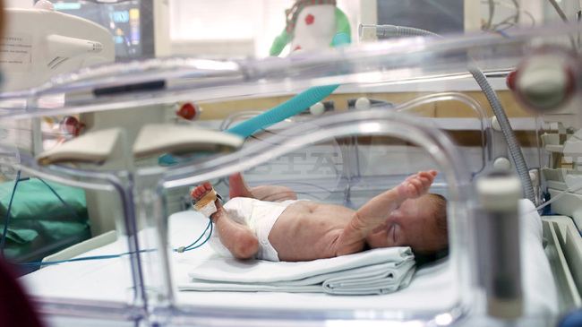 В Пловдив едно на осем деца се ражда недоносено, градът се включва в националната инициатива в подкрепа на преждевременно родените деца