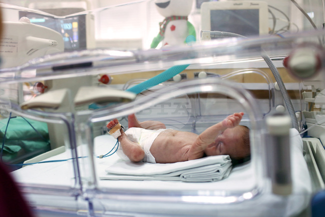 В Пловдив едно на осем деца се ражда недоносено, градът се включва в националната инициатива в подкрепа на преждевременно родените деца