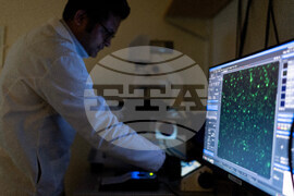 Be Well Autoimmune Diseases What to Know