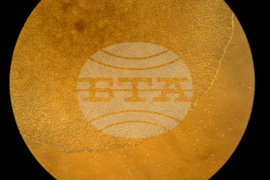 Autoimmunity New Treatments