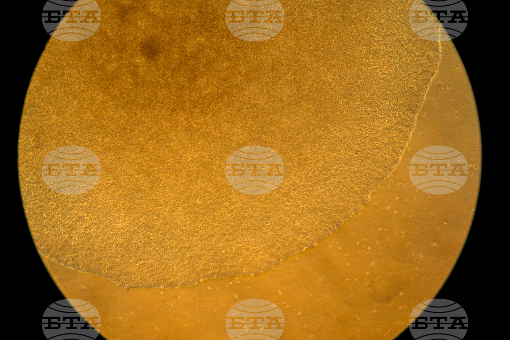 Autoimmunity New Treatments