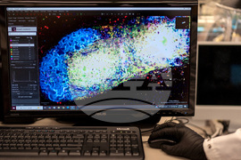 Autoimmunity New Treatments