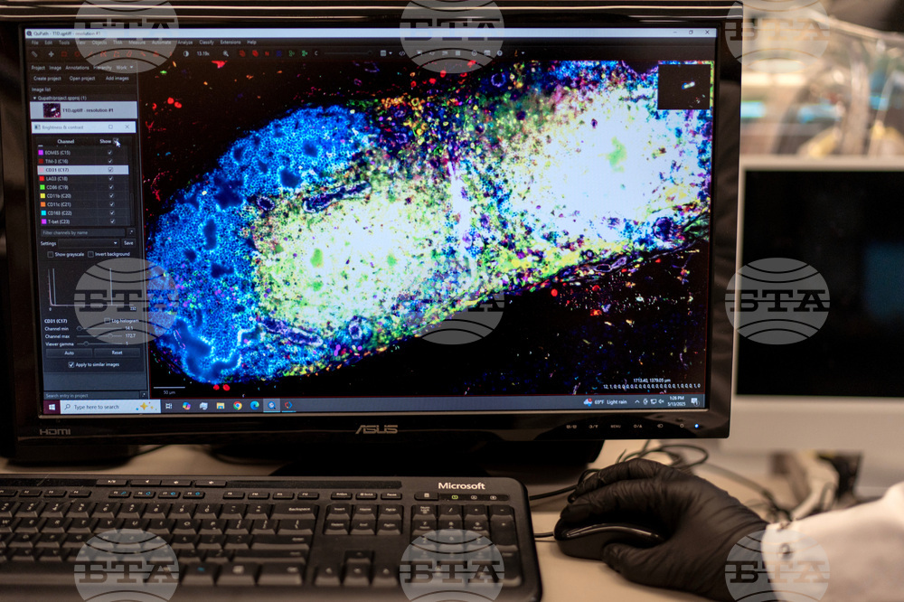 Autoimmunity New Treatments