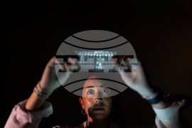 Autoimmune Disease Detectives Photo Essay