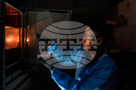 Autoimmune Disease Detectives Photo Essay