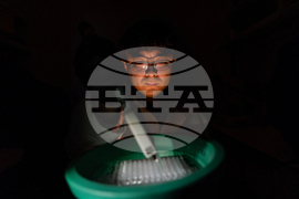 Autoimmune Disease Detectives Photo Essay