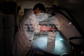 Autoimmune Disease Detectives Photo Essay