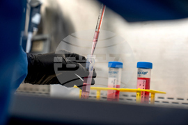 Autoimmunity New Treatments