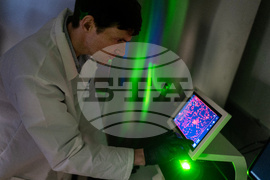 Autoimmunity New Treatments