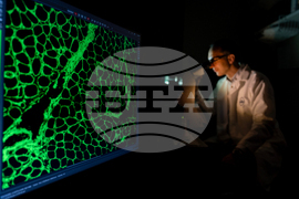 Autoimmune Disease Detectives Photo Essay